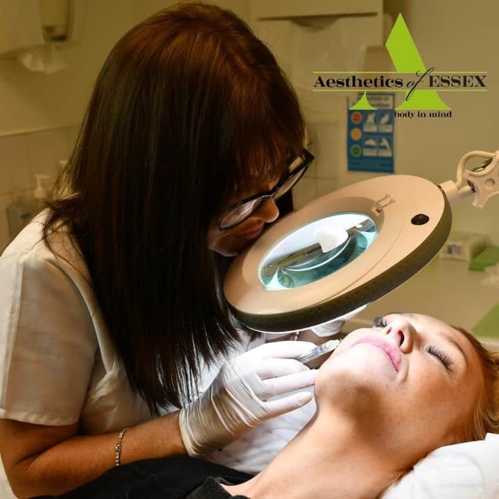 Instant facial filler improvements - Aesthetics of Essex