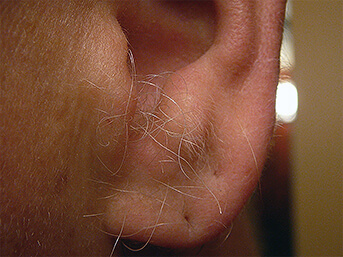 Hair
