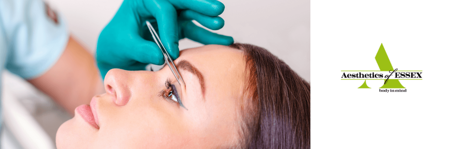 blepharoplasty surgery