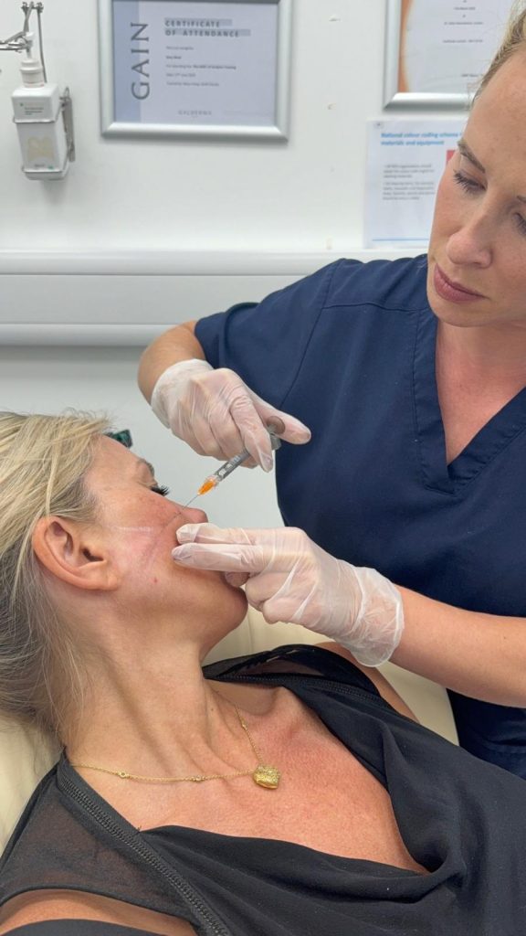 dermal filler