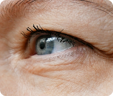 Ear, Eye & Facial Procedures – aesthetics concern treated at Aesthetics of Essex