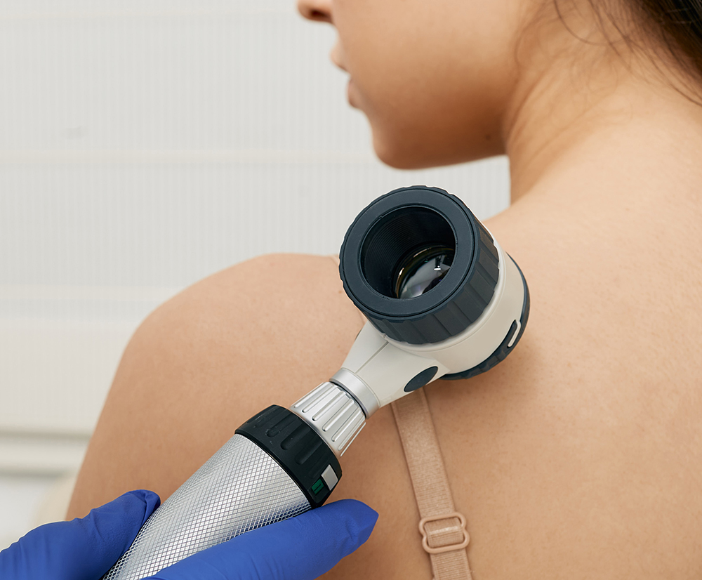 dermascope