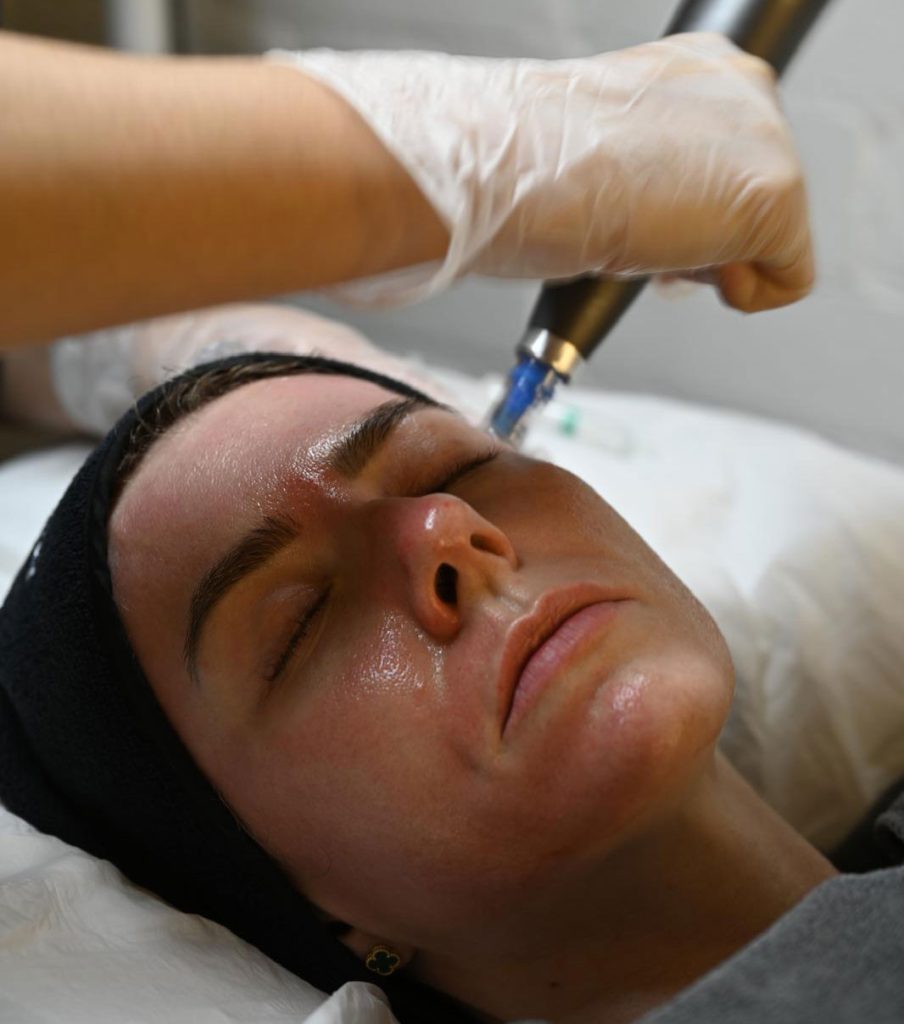 Dermapen