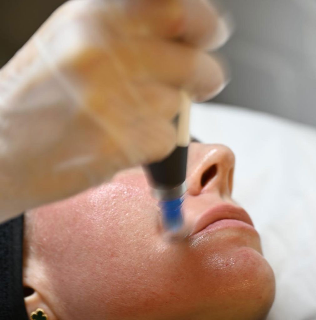 Dermapen