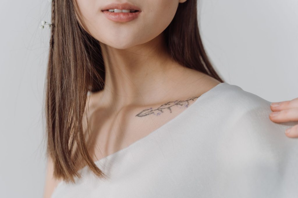 laser tattoo removal