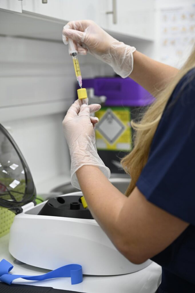 PRP needles
