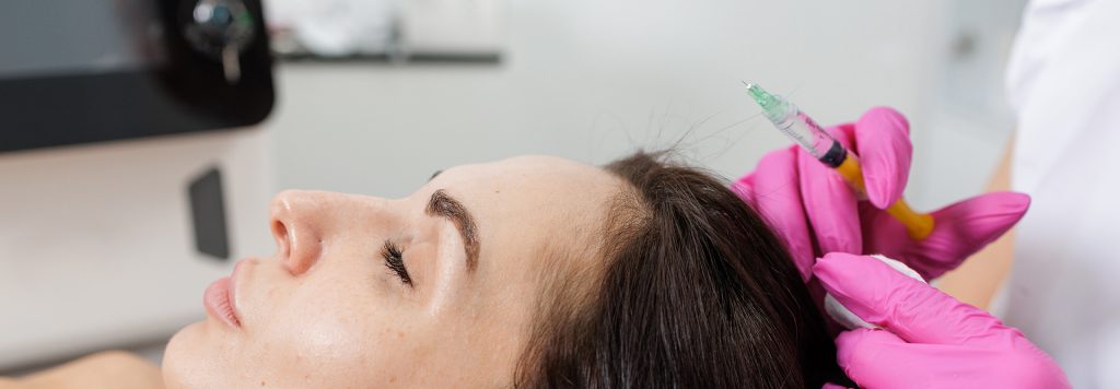 prp hair treatment