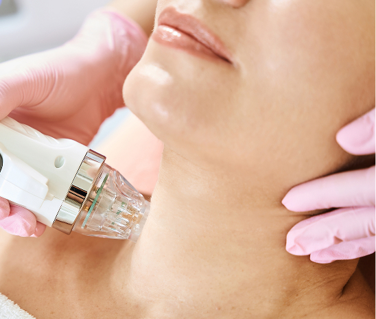 Dermapen