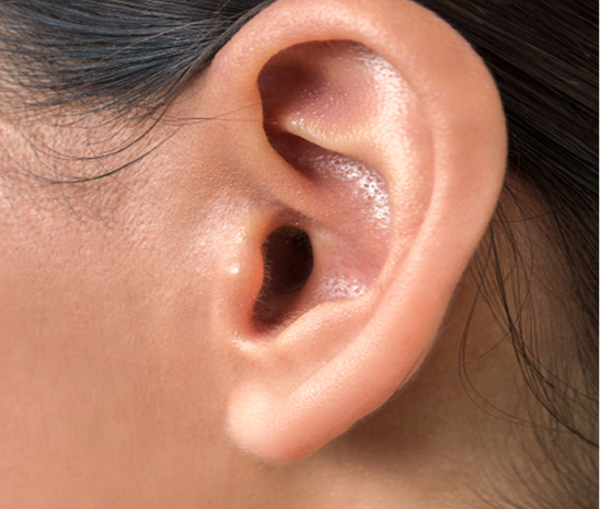 Close-up of an ear for earlobe correction treatment