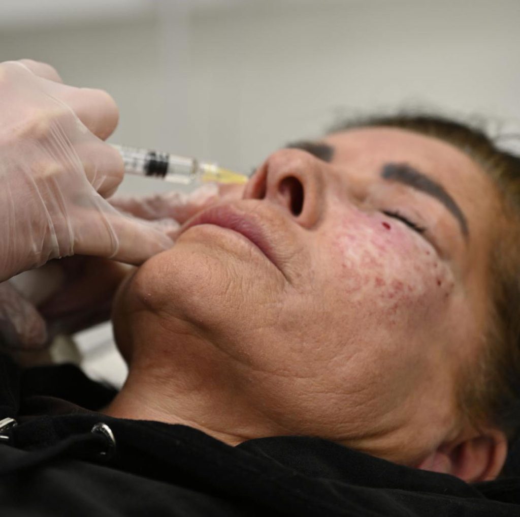 injectable
