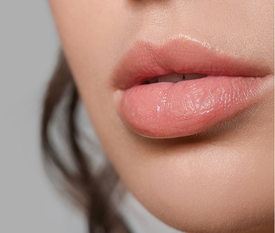 Close-up of enhanced lips after lip filler treatment