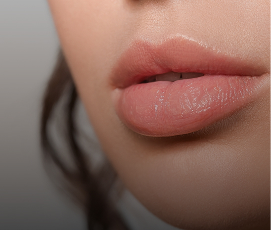 Close-up of enhanced lips after lip filler treatment