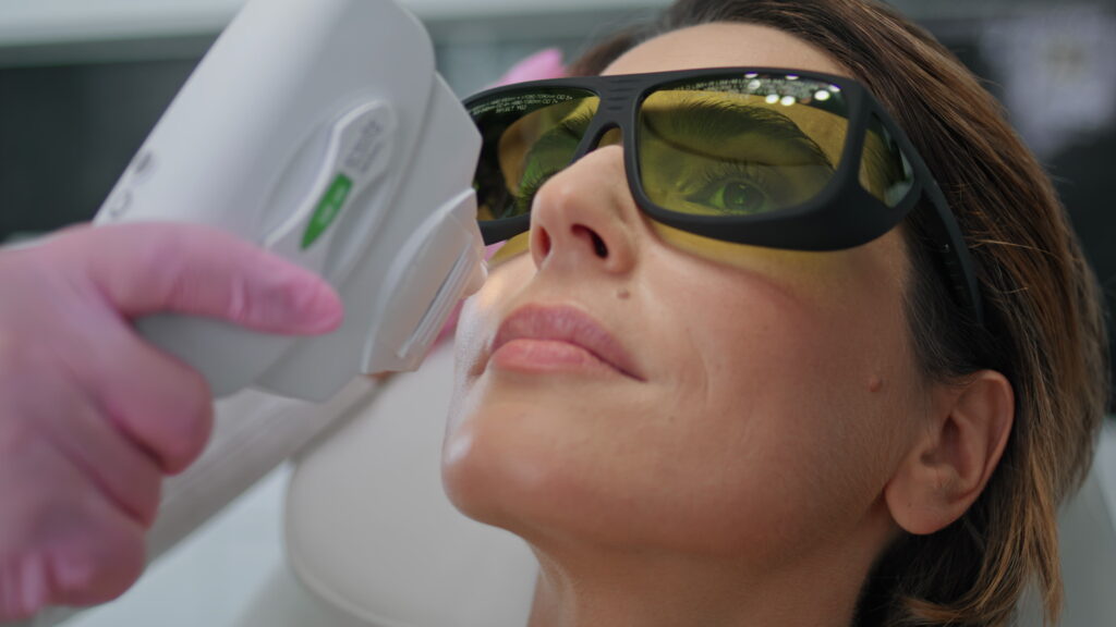 IPL treatment procedure in Essex